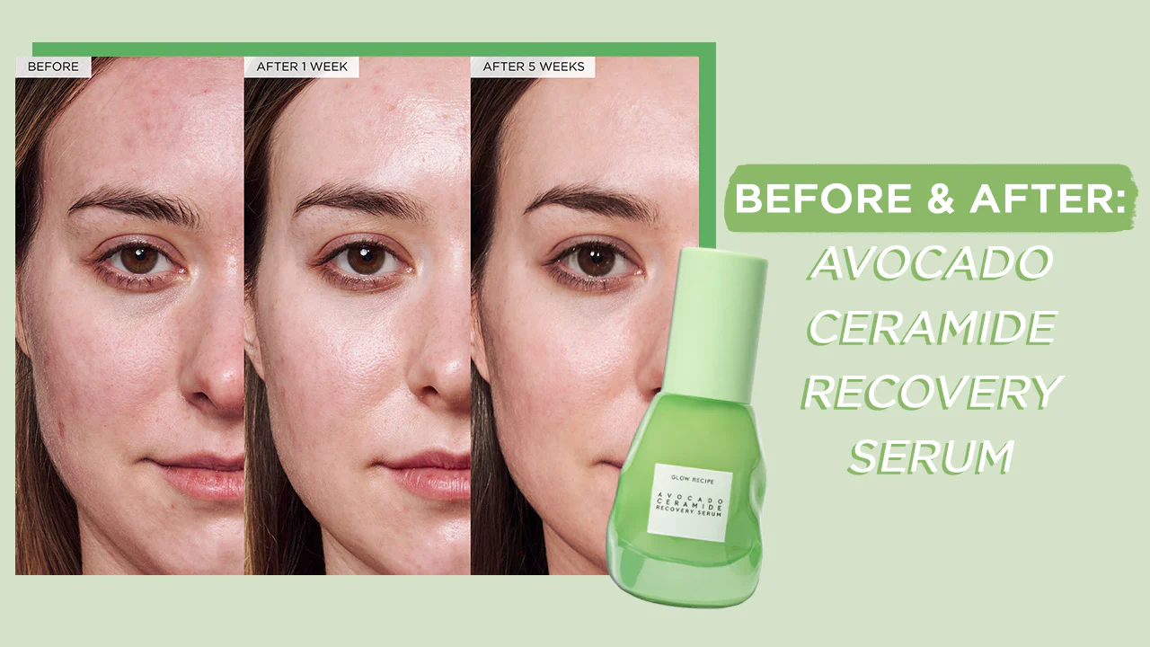 Avocado Ceramide Recovery Serum - Image 10
