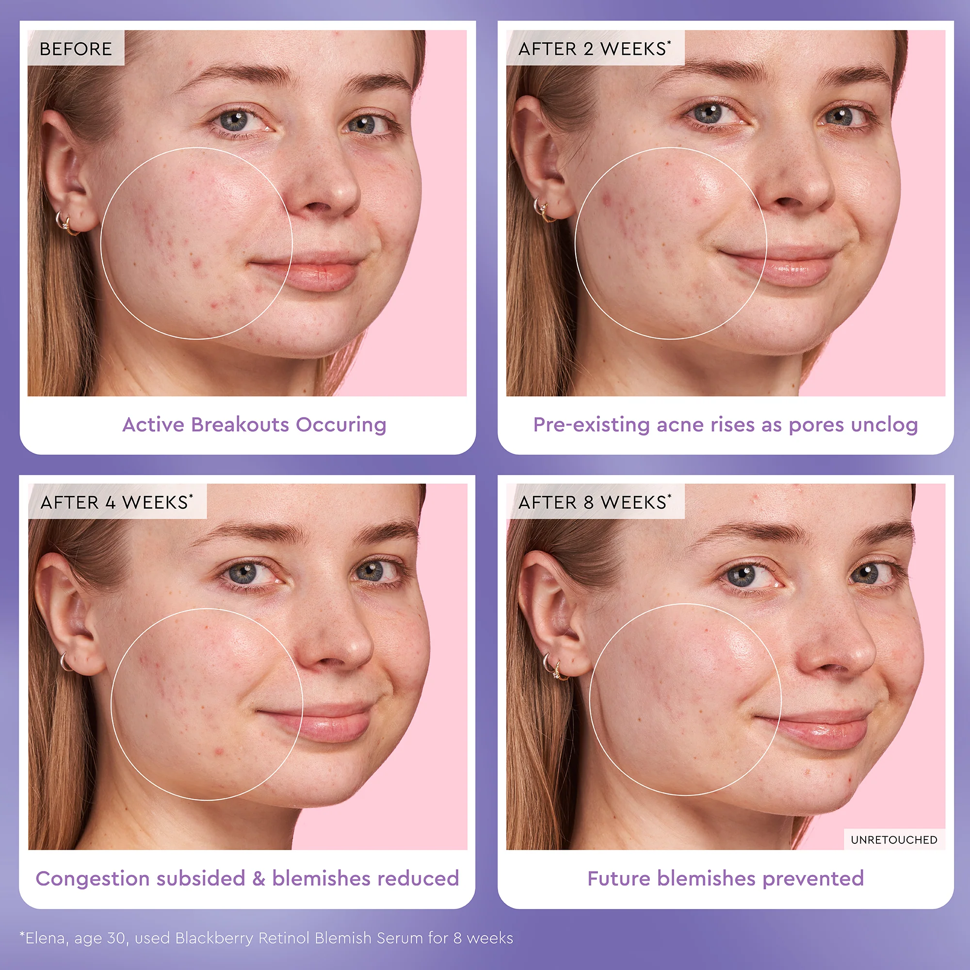 Blackberry Retinol Blemish Serum - Image 4