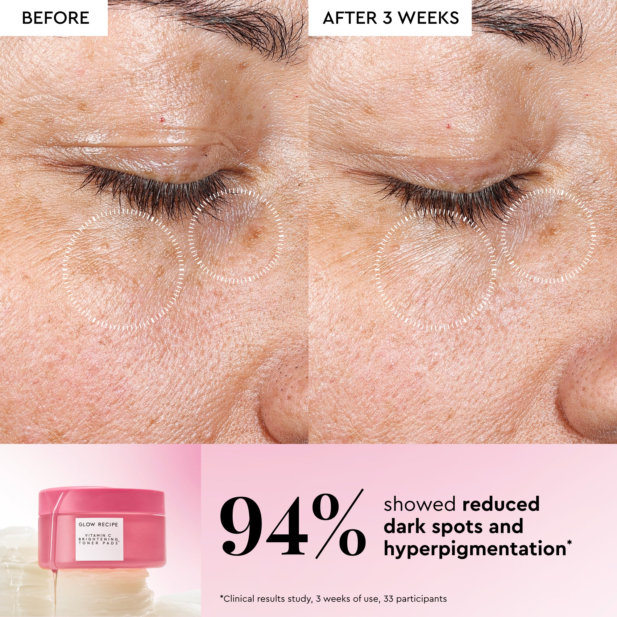 Korean Toner Pad Trial & Travel Kit - Image 4