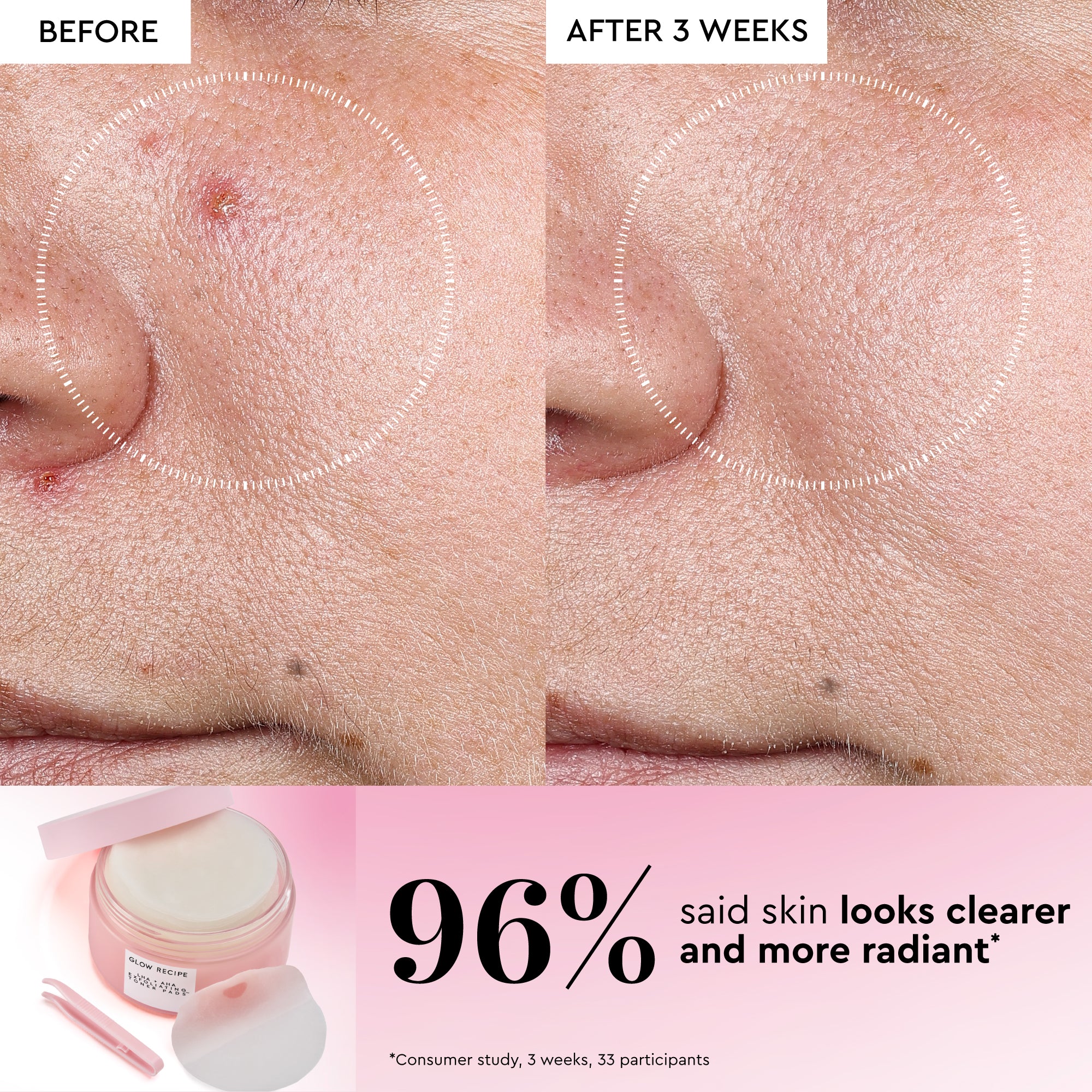 Korean Toner Pad Trial & Travel Kit - Image 8
