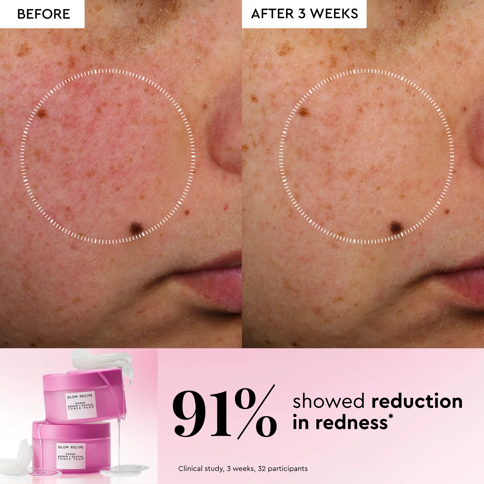 PDRN+ Repair + Soothe Korean Toner Pads - Image 3