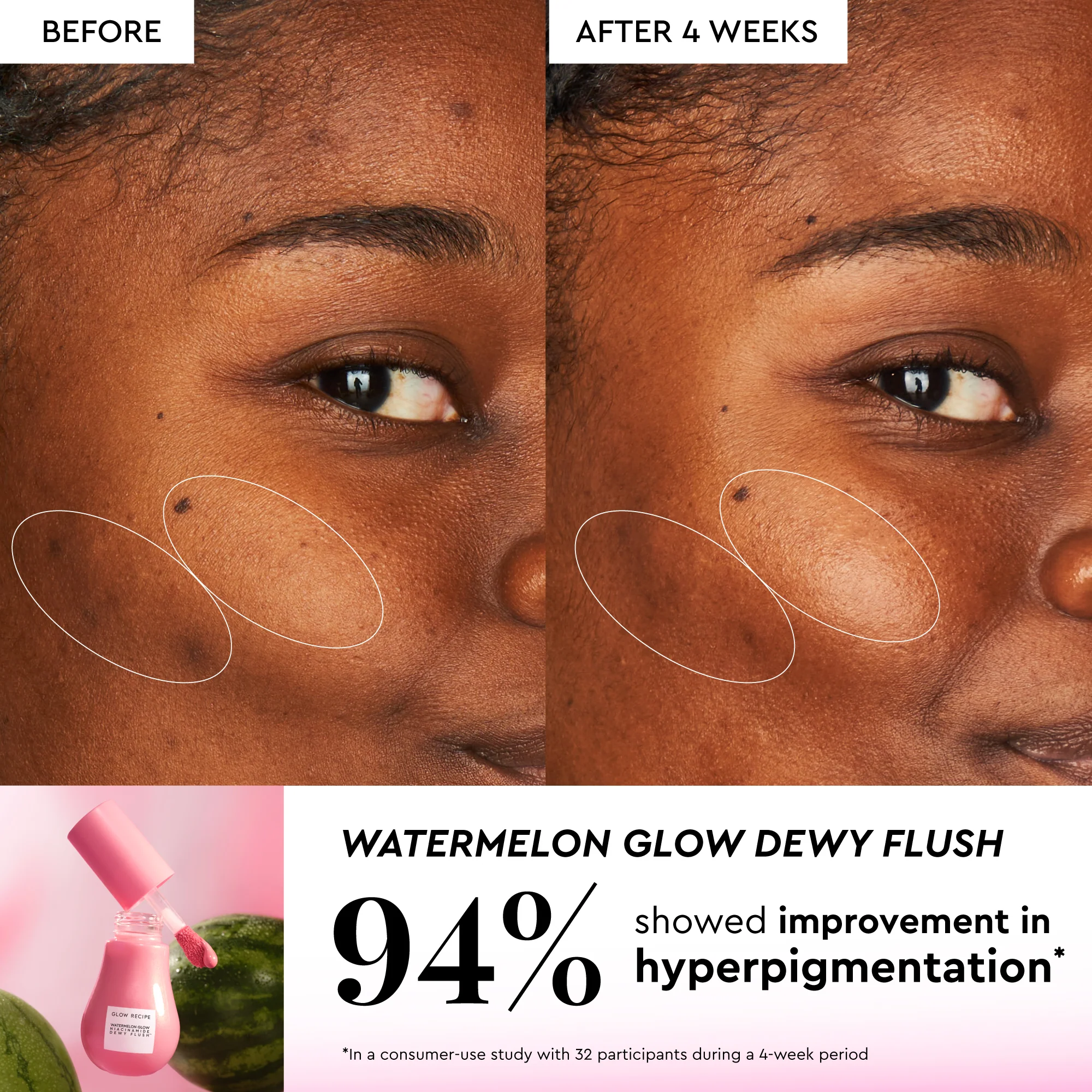 Watermelon Glow Best-Sellers Kit - Image 7