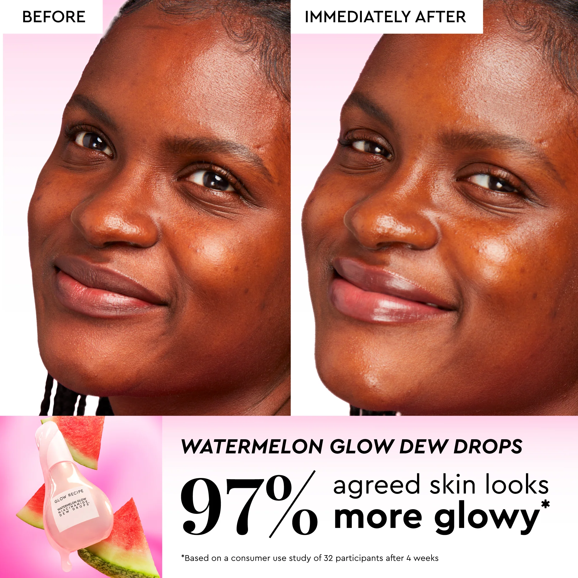Watermelon Glow Best-Sellers Kit - Image 9