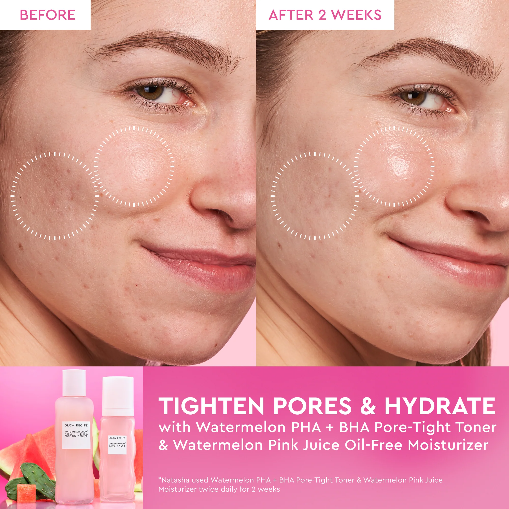 Watermelon Glow Dewy Skin Routine - Image 6